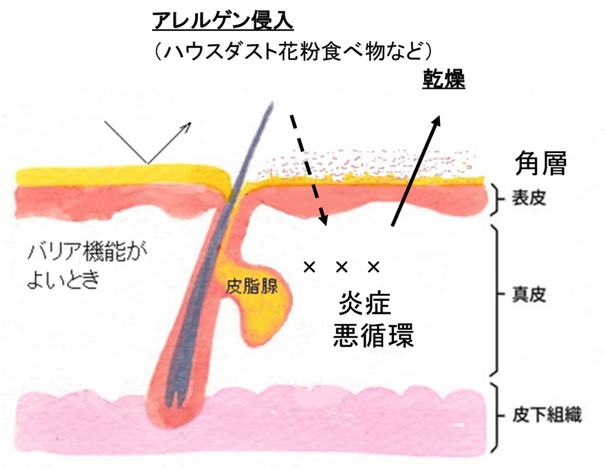 皮膚バリア機能イメージ